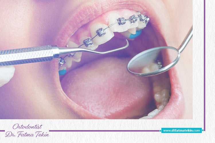 Ortodontist_Dr._Fatma_Tekin